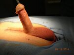 Burst Vein Penis